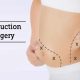 Liposuction surgery in India